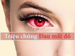 TUYÊN TRUYỀN PHÒNG BỆNH ĐAU MẮT ĐỎ